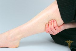 Причины и лечение судорог в ногах